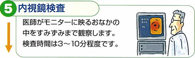 内視鏡検査
